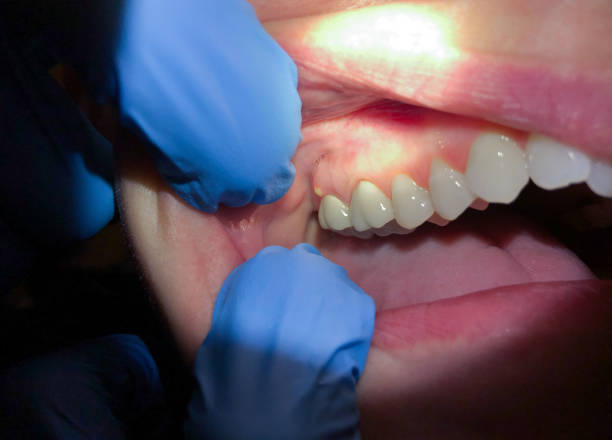  Moreauville, LA Emergency Dentist Pros