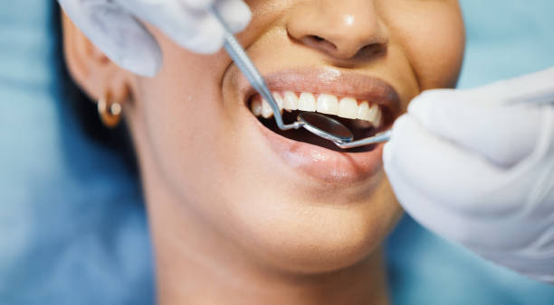 Best Orthodontic Emergency Dentist in Moreauville, LA