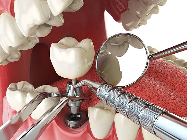 Best Pediatric Emergency Dentist in Moreauville, LA